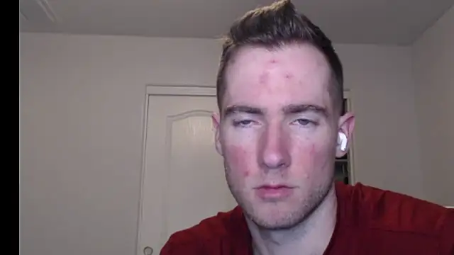 rawdawgrex online show from March 7, 7:16 am